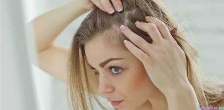 Что предпринять, чтобы не облысеть после 30+, пьем необходимые витамины для предотвращения выпадения волос