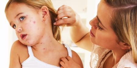 Аллергия на коже у ребенка лечение форум