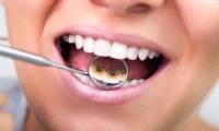 Брекет-система: чтобы зубы были ровными, а улыбка красивая
